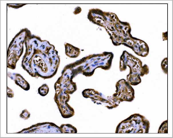 product-image-AAA19357_IHC2.jpg
