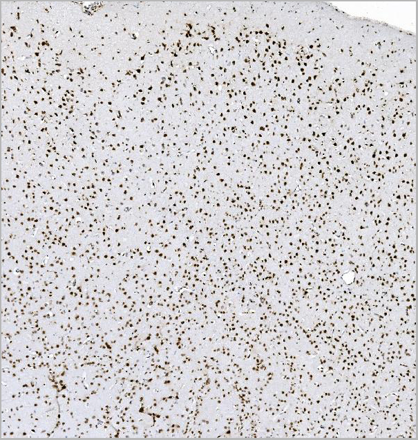 product-image-AAA19388_IHC3.jpg