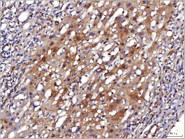 product-image-AAA19420_IHC6.jpg