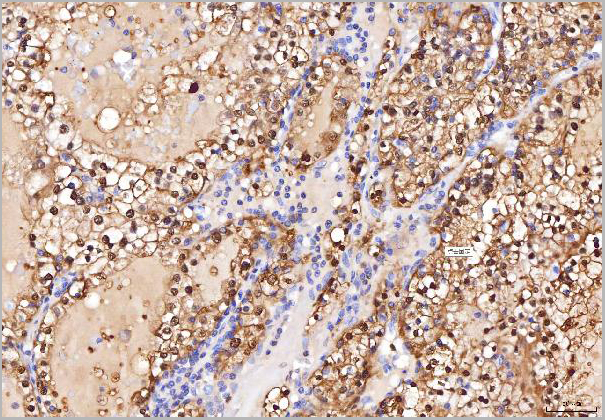 product-image-AAA19420_IHC9.jpg