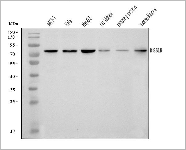 product-image-AAA19421_WB.jpg