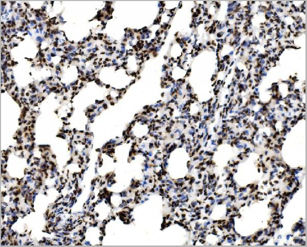 product-image-AAA19422_IHC12.jpg