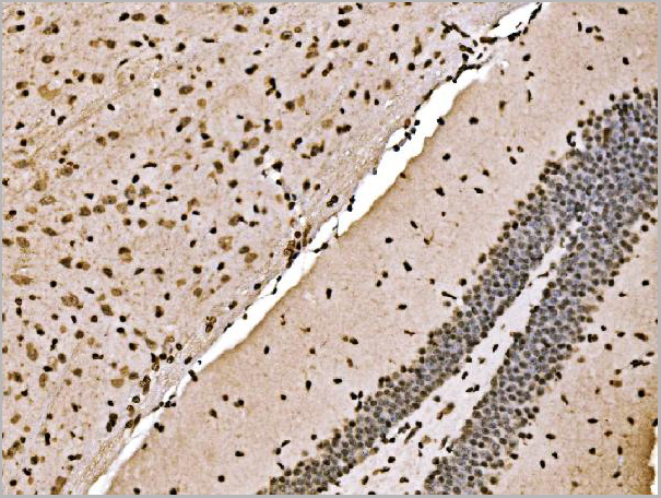 product-image-AAA19422_IHC13.jpg