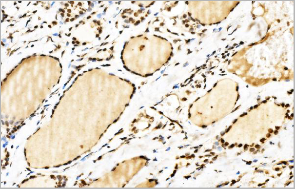 product-image-AAA19422_IHC4.jpg