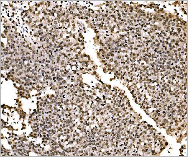 product-image-AAA19422_IHC8.jpg