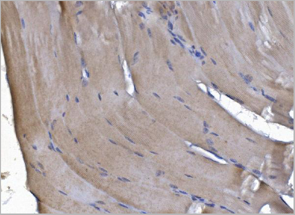 product-image-AAA19423_IHC4.jpg