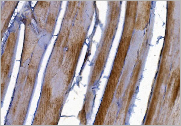 product-image-AAA19423_IHC5.jpg