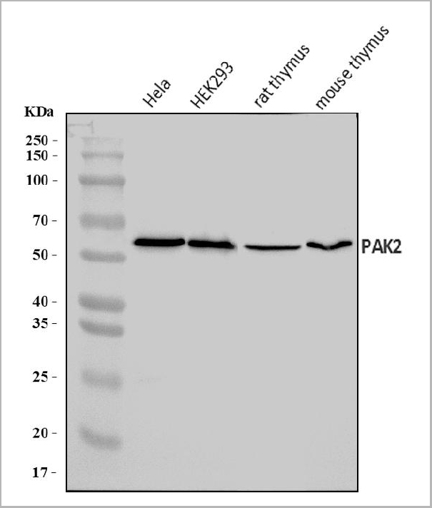product-image-AAA19423_WB.jpg