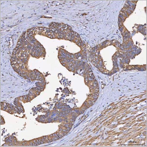 product-image-AAA19425_IHC4.jpg
