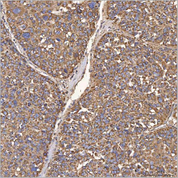 product-image-AAA19425_IHC6.jpg
