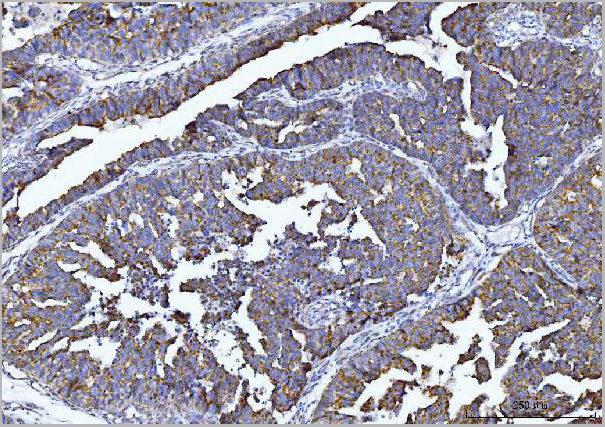 product-image-AAA19426_IHC2.jpg