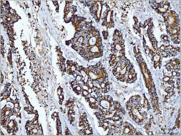 product-image-AAA19426_IHC3.jpg