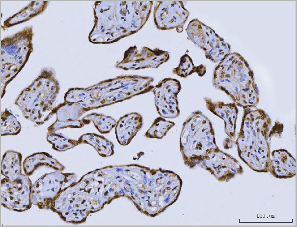 product-image-AAA19427_IHC2.jpg