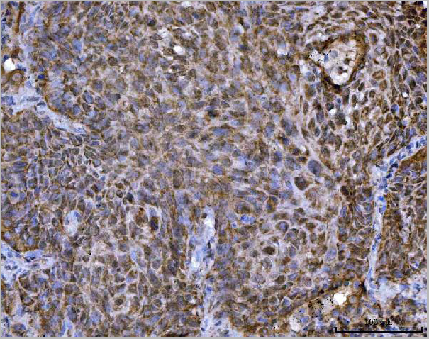 product-image-AAA19428_IHC2.jpg