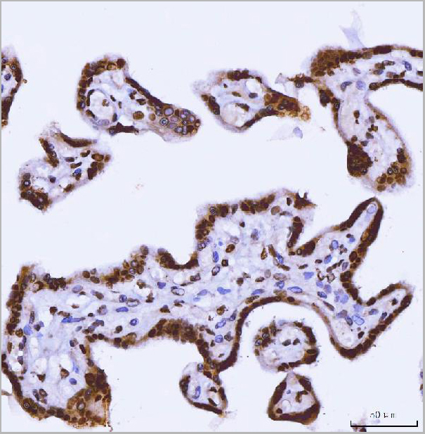 product-image-AAA19428_IHC3.jpg