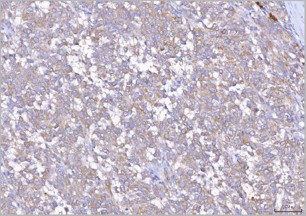 product-image-AAA19429_IHC3.jpg