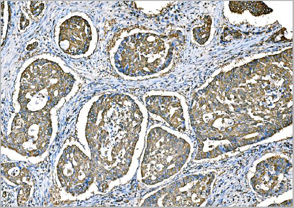 product-image-AAA19430_IHC2.jpg