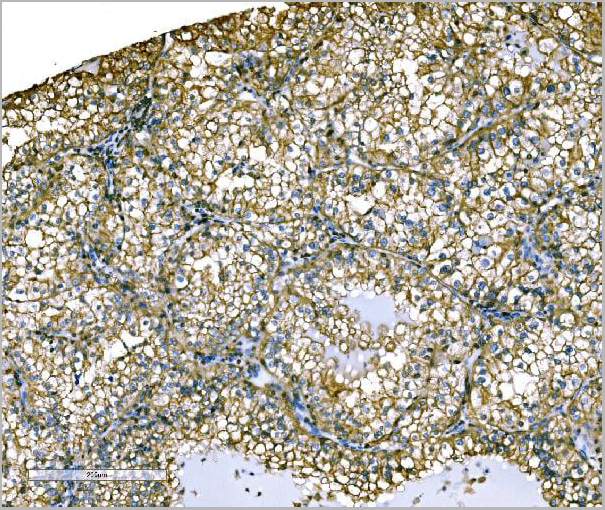 product-image-AAA19430_IHC4.jpg