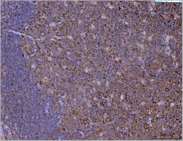 product-image-AAA19431_IHC4.jpg