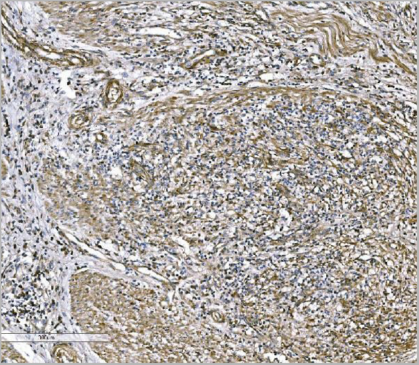 product-image-AAA19432_IHC2.jpg