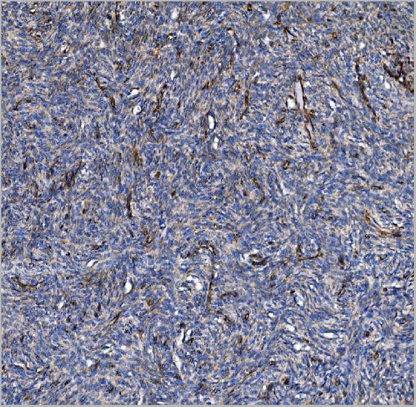 product-image-AAA19432_IHC4.jpg