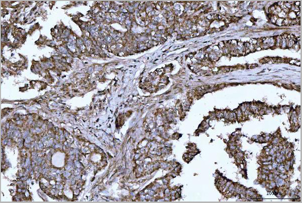 product-image-AAA19433_IHC2.jpg