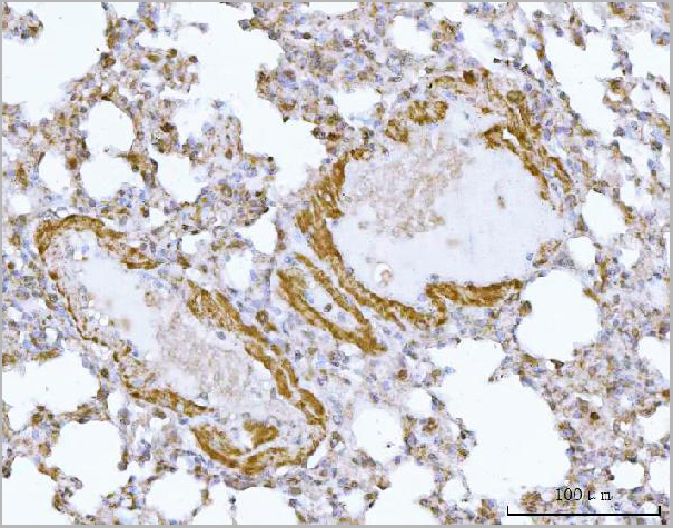 product-image-AAA19433_IHC4.jpg