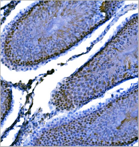product-image-AAA19434_IHC2.jpg