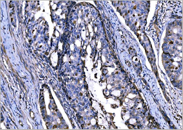 product-image-AAA19434_IHC3.jpg