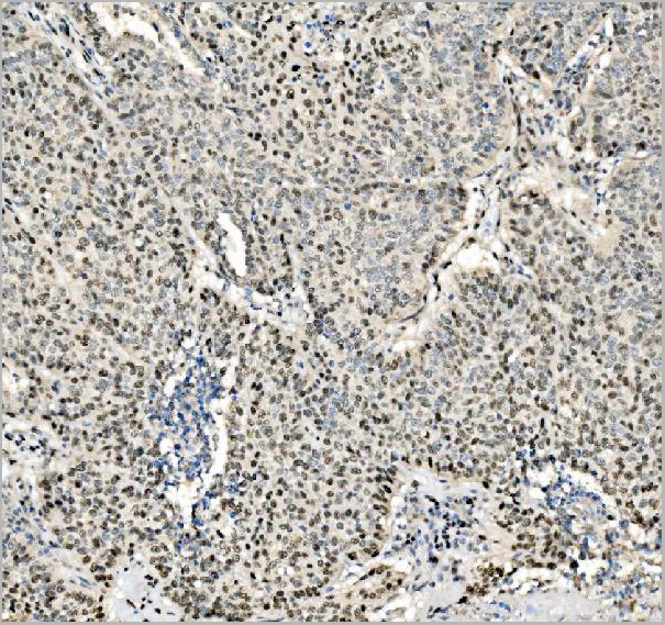 product-image-AAA19435_IHC3.jpg
