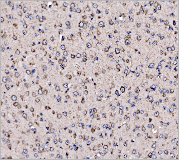 product-image-AAA19436_IHC4.jpg