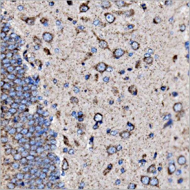 product-image-AAA19436_IHC5.jpg