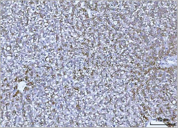 product-image-AAA19437_IHC12.jpg