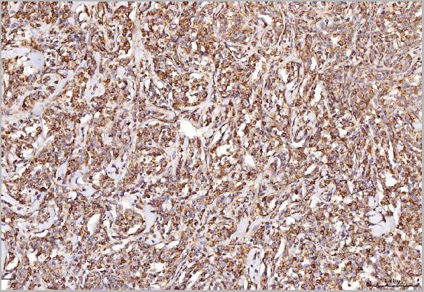 product-image-AAA19438_IHC4.jpg