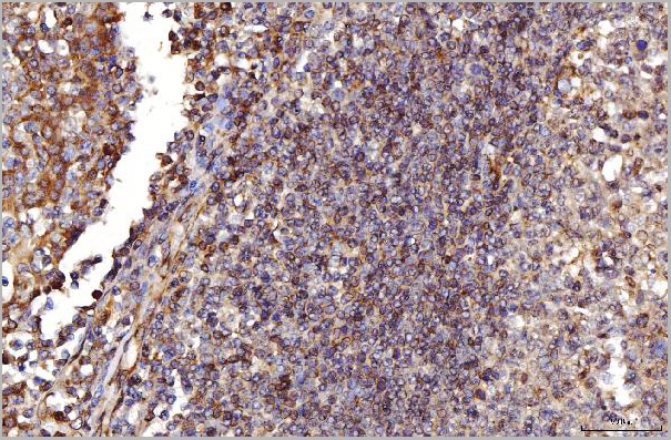 product-image-AAA19438_IHC6.jpg