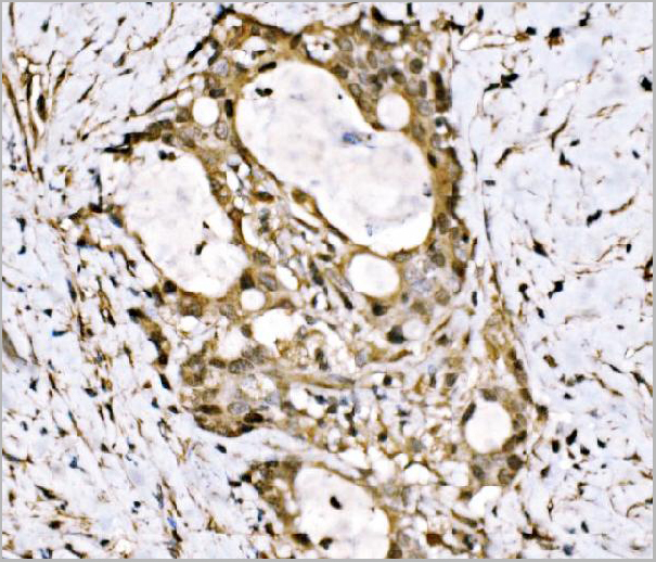 product-image-AAA19496_IHC2.jpg