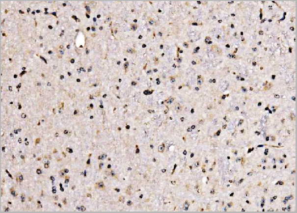 product-image-AAA19496_IHC4.jpg