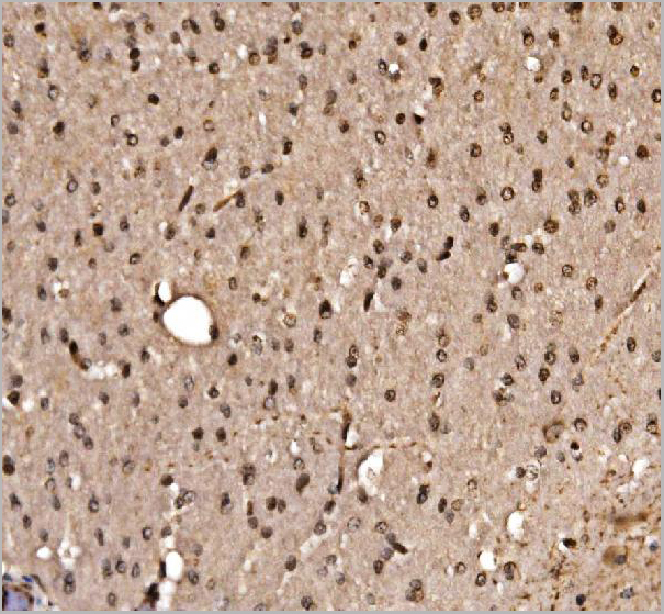 product-image-AAA19496_IHC5.jpg