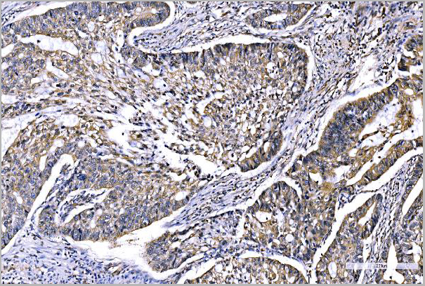 product-image-AAA19514_IHC2.jpg