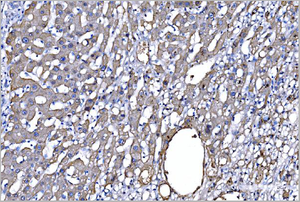 product-image-AAA19514_IHC3.jpg