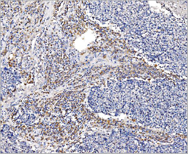 product-image-AAA19514_IHC5.jpg