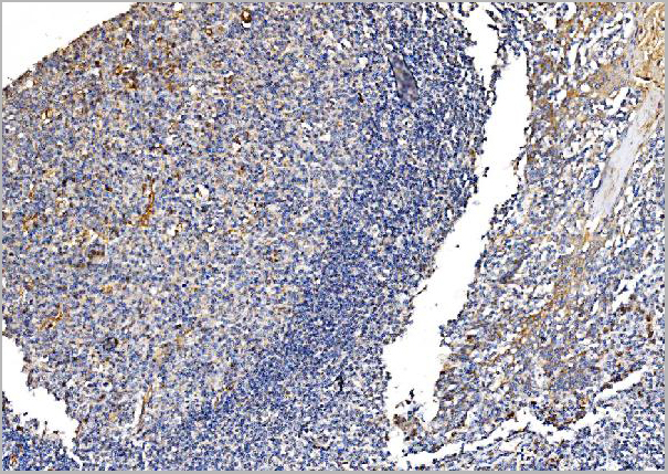 product-image-AAA19514_IHC6.jpg