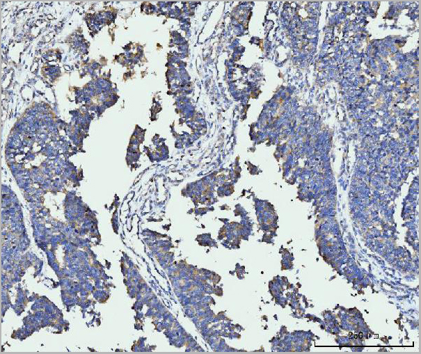 product-image-AAA19713_IHC.jpg