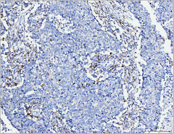 product-image-AAA19713_IHC2.jpg