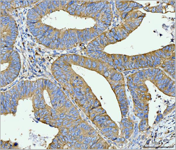 product-image-AAA19713_IHC5.jpg
