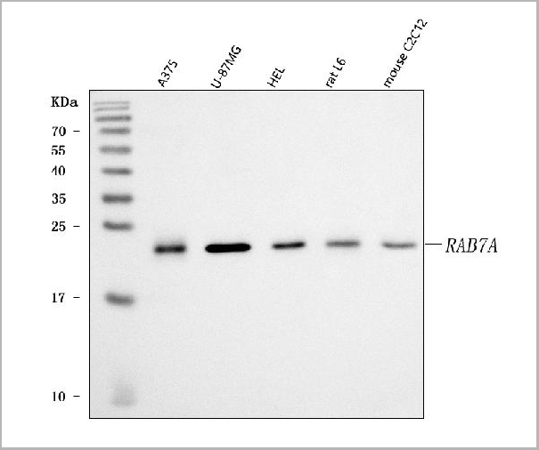product-image-AAA19775_WB.jpg