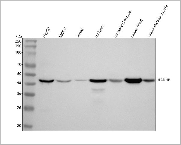 product-image-AAA19823_WB.jpg