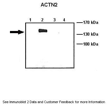 product-image-AAA198914_WB11.jpg