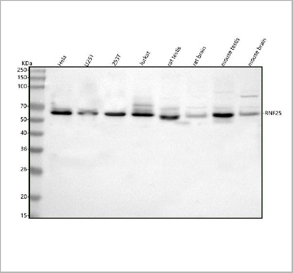 product-image-AAA19946_WB.jpg