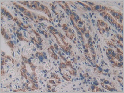 product-image-AAA20071_IHC3.jpg